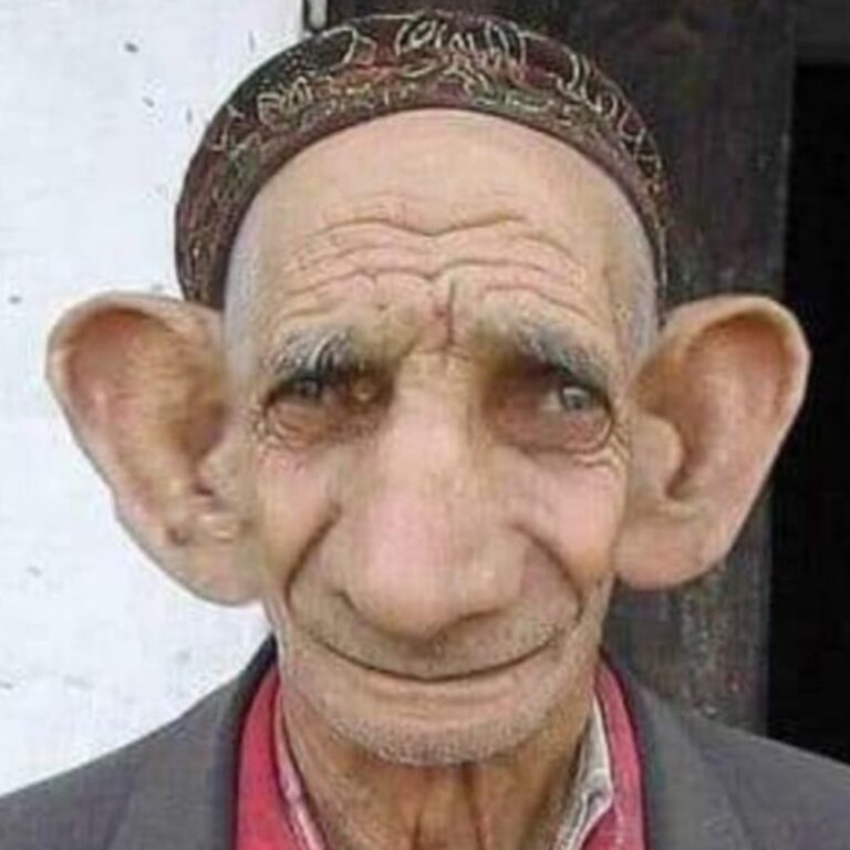 Goofy Ahh: Big-Eared Gentleman Smiles